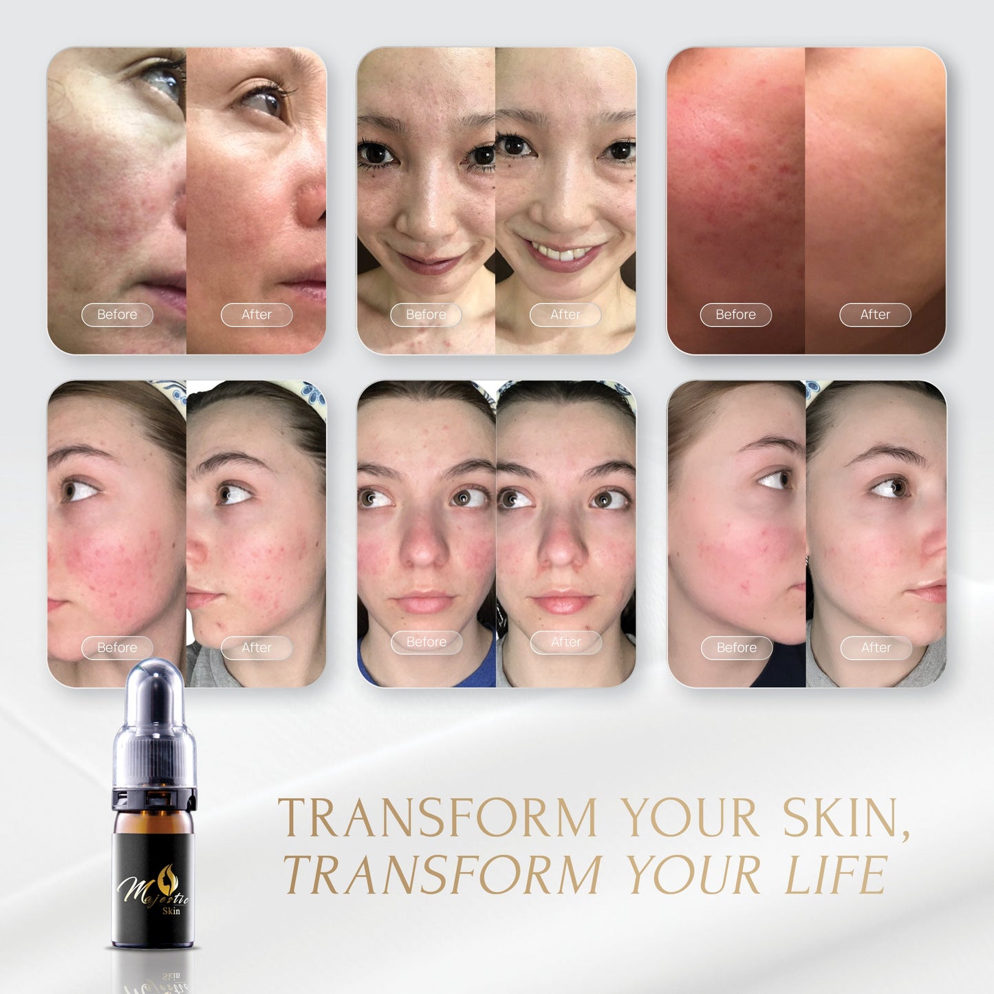 Human stem cell serum Majestic Skin 5ml